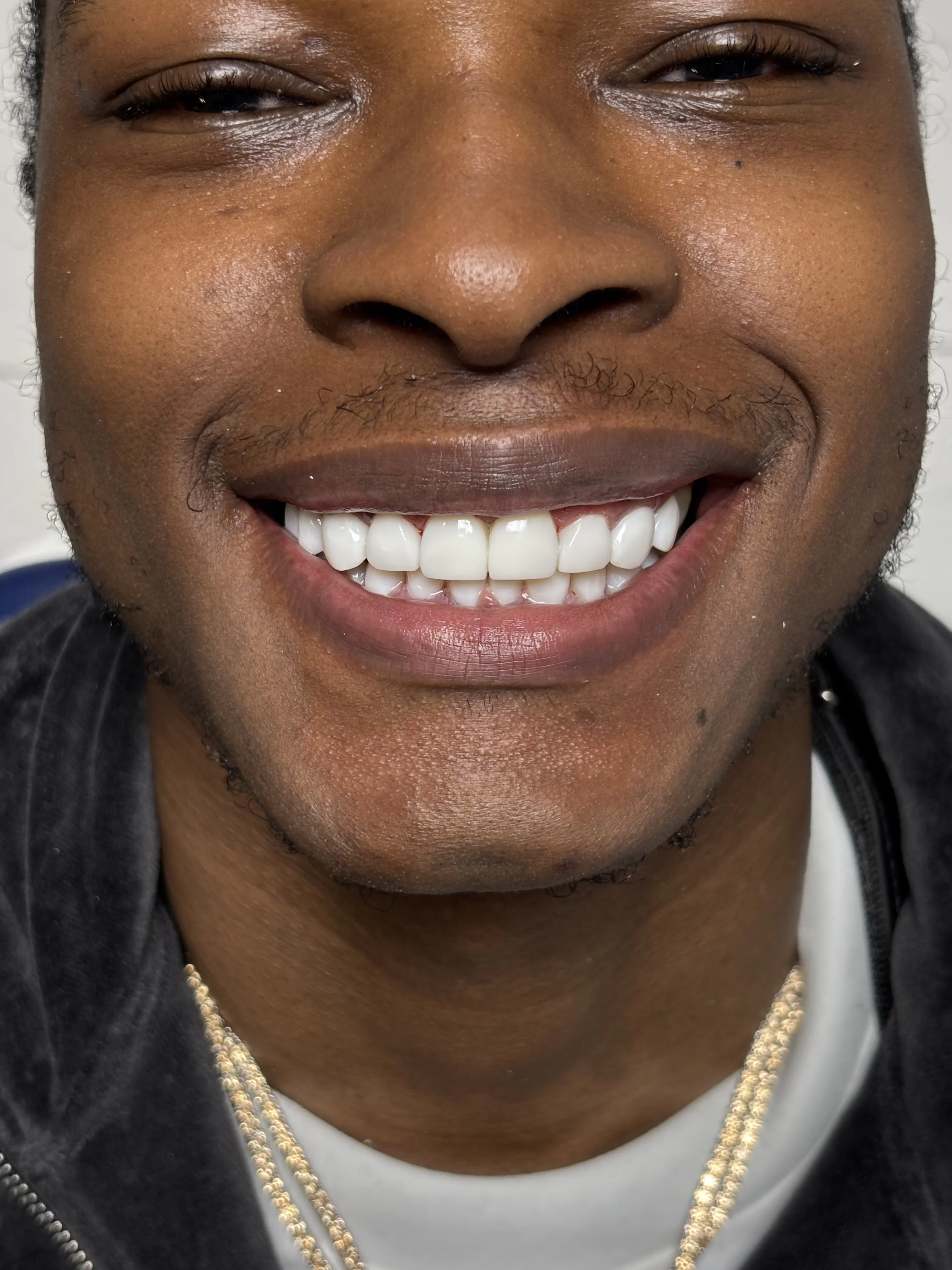 After: restored natural appearance