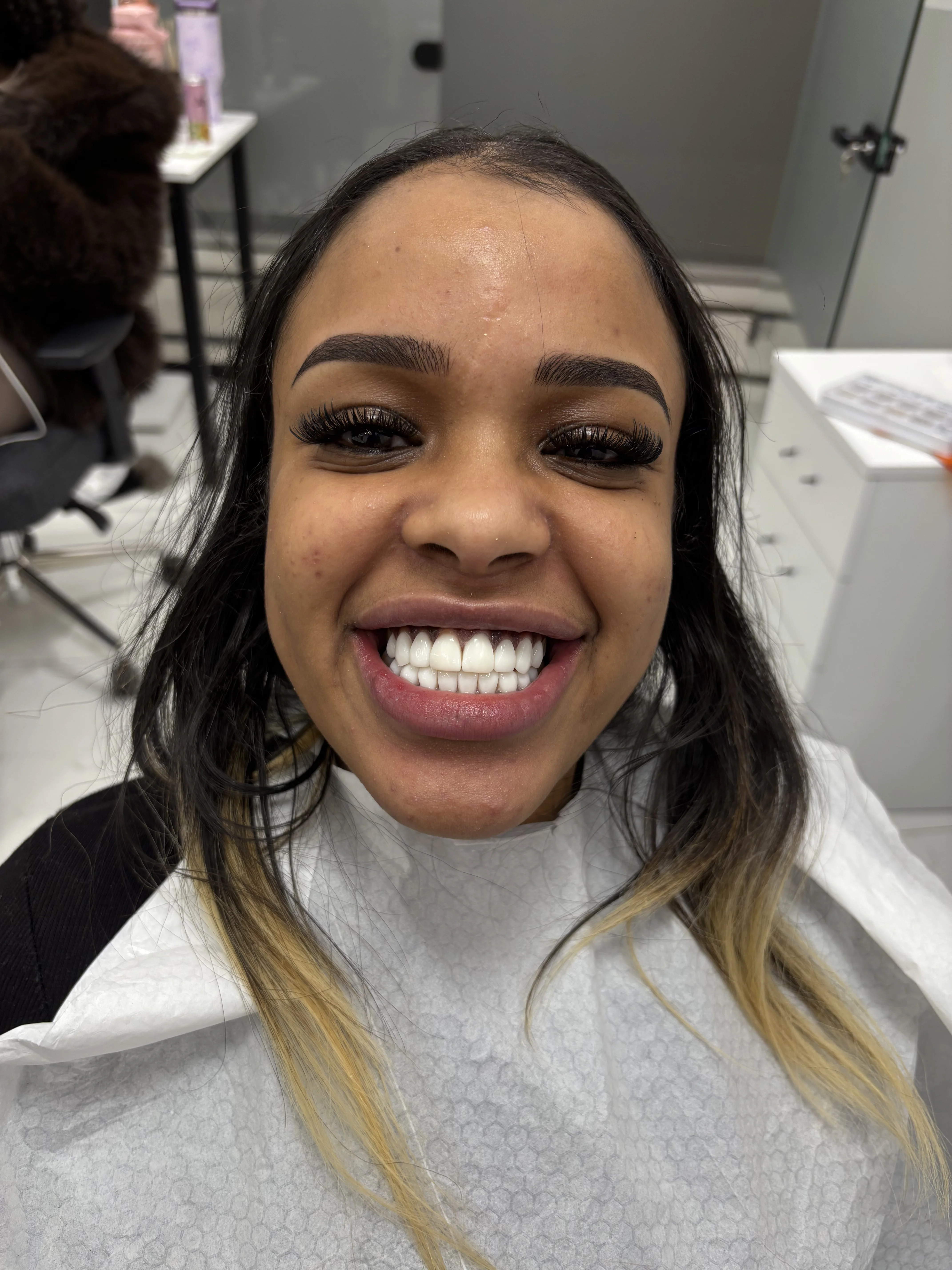 Before: asymmetrical tooth shape