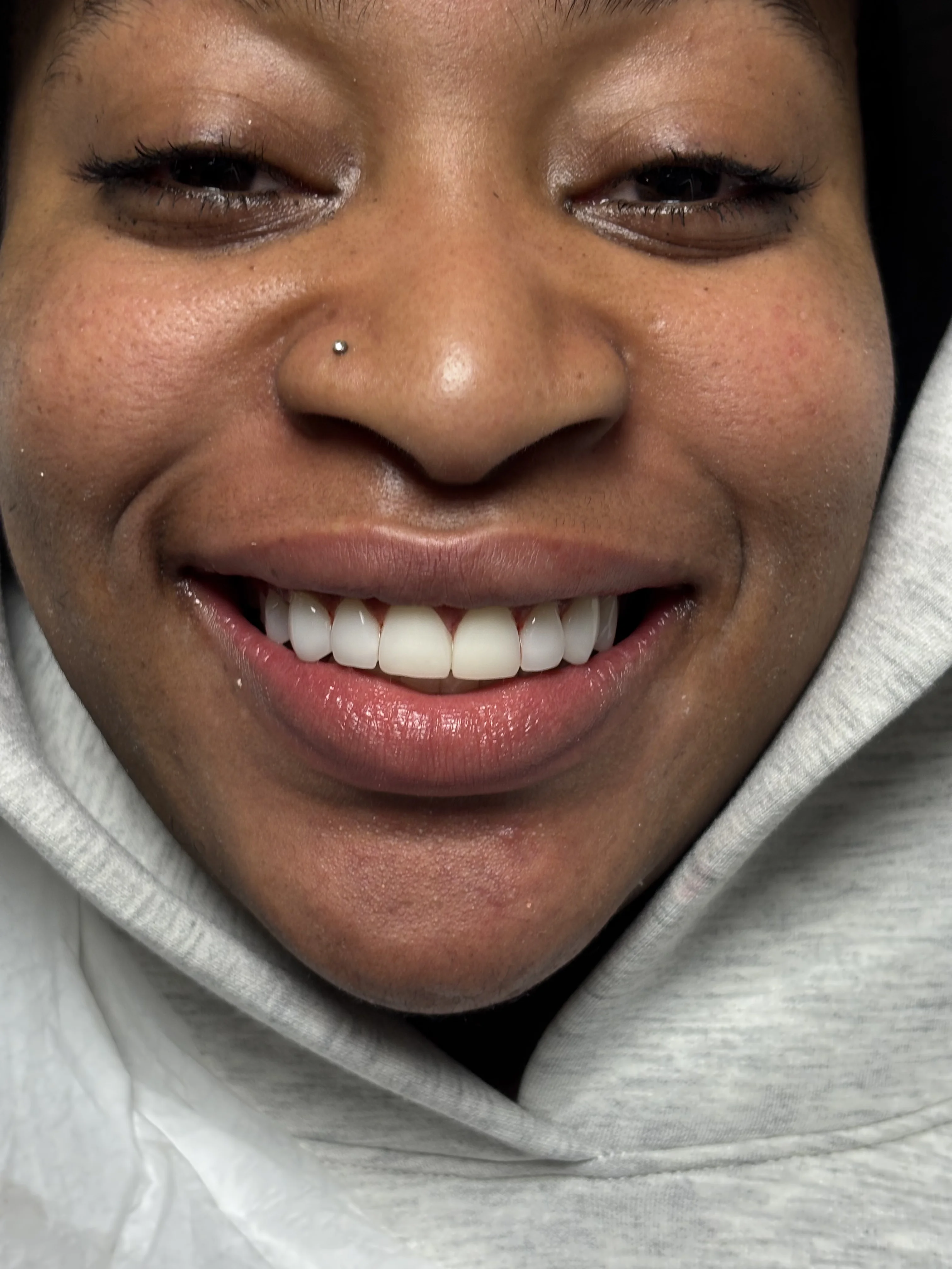 After: unified, beautiful smile